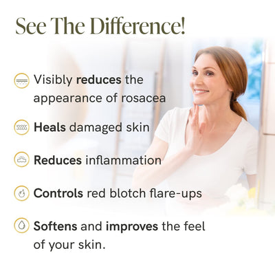 Bee Rx™ Rosacea Treatment Cream - Redness Relief for Face Cream ...